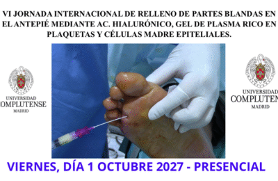 Jornada Internacional de Relleno de Partes Blandas en el Antepié mediante Ac. Hialurónico, Gel de Plasma Rico en Plaquetas y Células Madre Epiteliales.