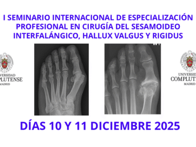 SEMINARIO INTERNACIONAL DE ESPECIALIZACIÓN PROFESIONAL EN CIRUGÍA DEL SESAMOIDEO INTERFALÁNGICO, HALLUX VALGUS Y RIGIDUS