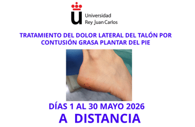 TRATAMIENTO DEL DOLOR LATERAL DEL TALÓN POR CONTUSIÓN GRASA PLANTAR DEL PIE